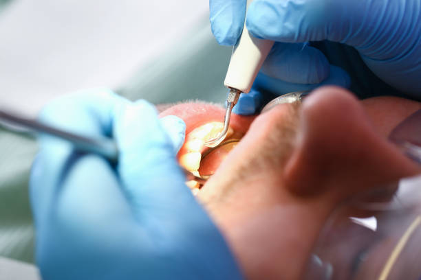 Best Walk-In Emergency Dental Services in Scott Af, IL