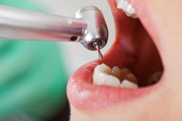 Best 24-Hour Emergency Dental Care in Scott Af, IL